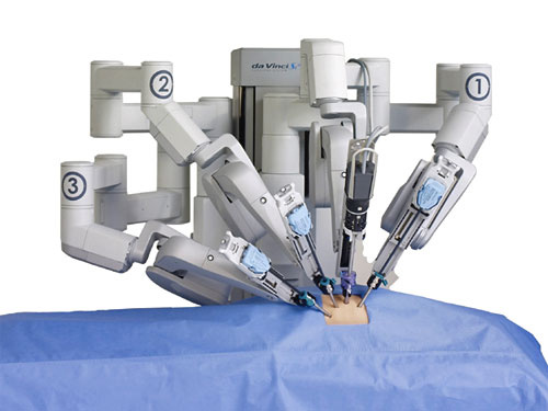 Davinci Robot used in Robotic Surgery Philippines