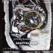 MRI View 19-1030-1