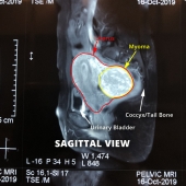 MRI View 19-1030-2