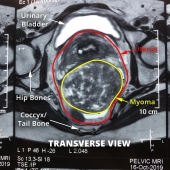 MRI View 19-1030-3